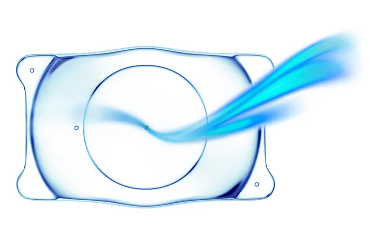 眼内コンタクトレンズ（ICL）について