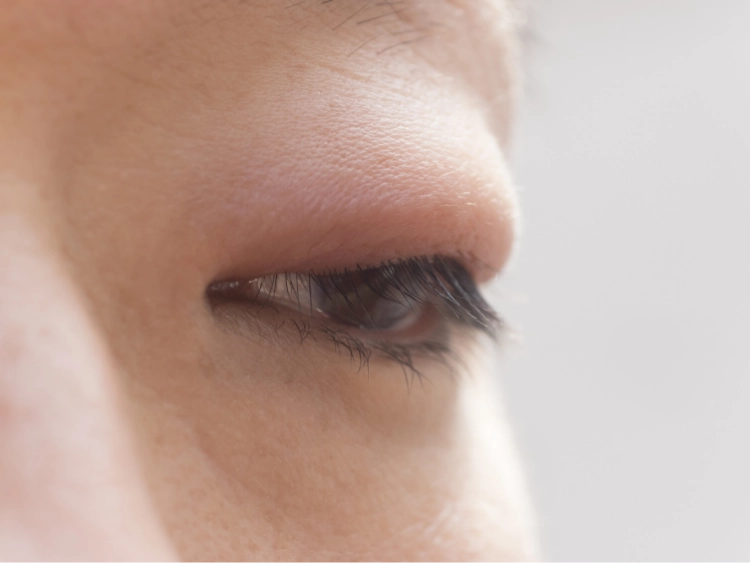 まぶたのできもの